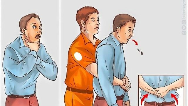 Heimlich Manevrası: Hayatı Kurtaran Basit Bir Teknik